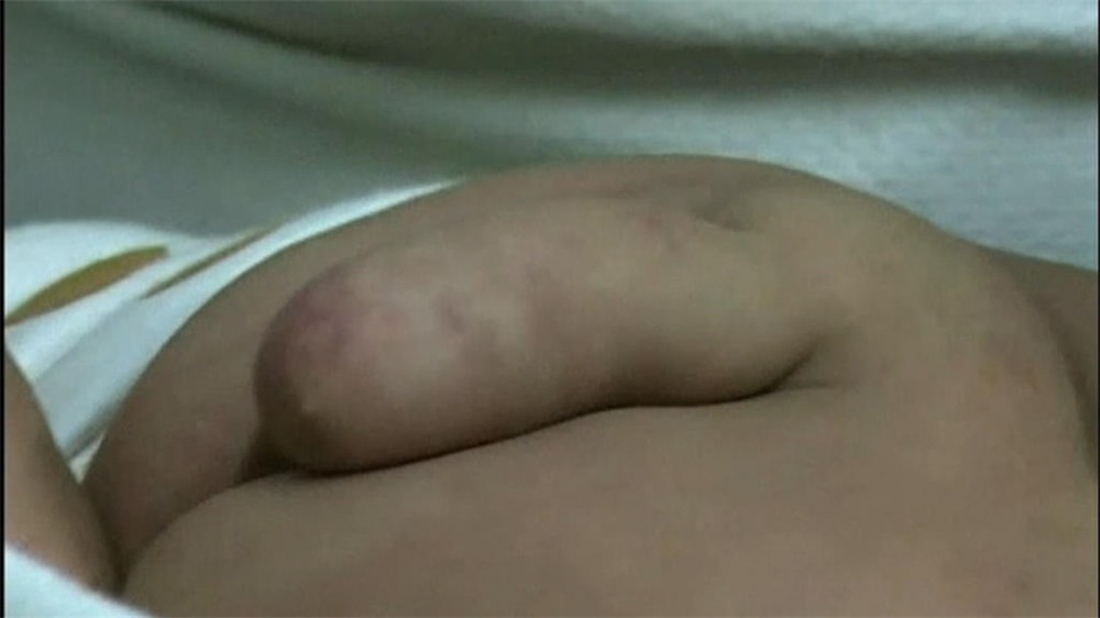 Chinese baby heeft staart