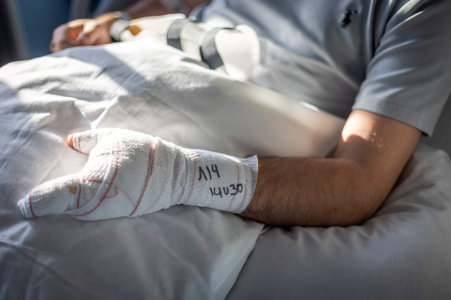 “Papa, mijn hand is eraf”: Jesse (21) verliest vingers bij ongeval met ...