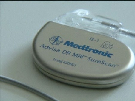 Nieuwe pacemaker voorgesteld | GVA